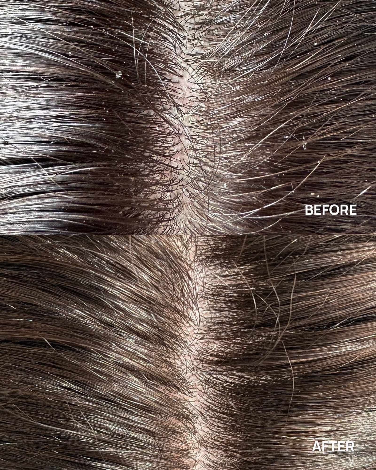 before after