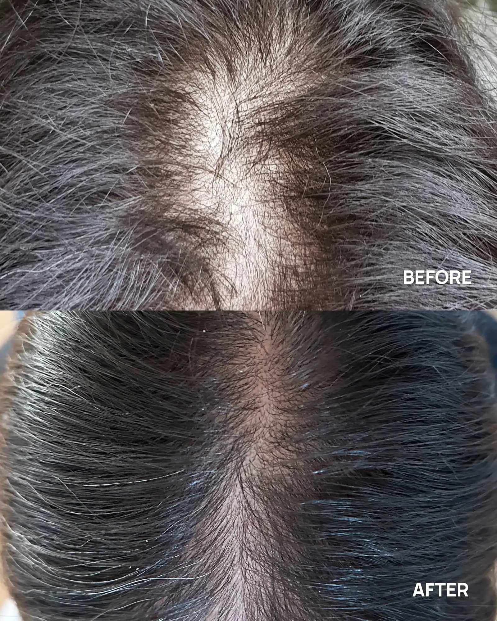 before after