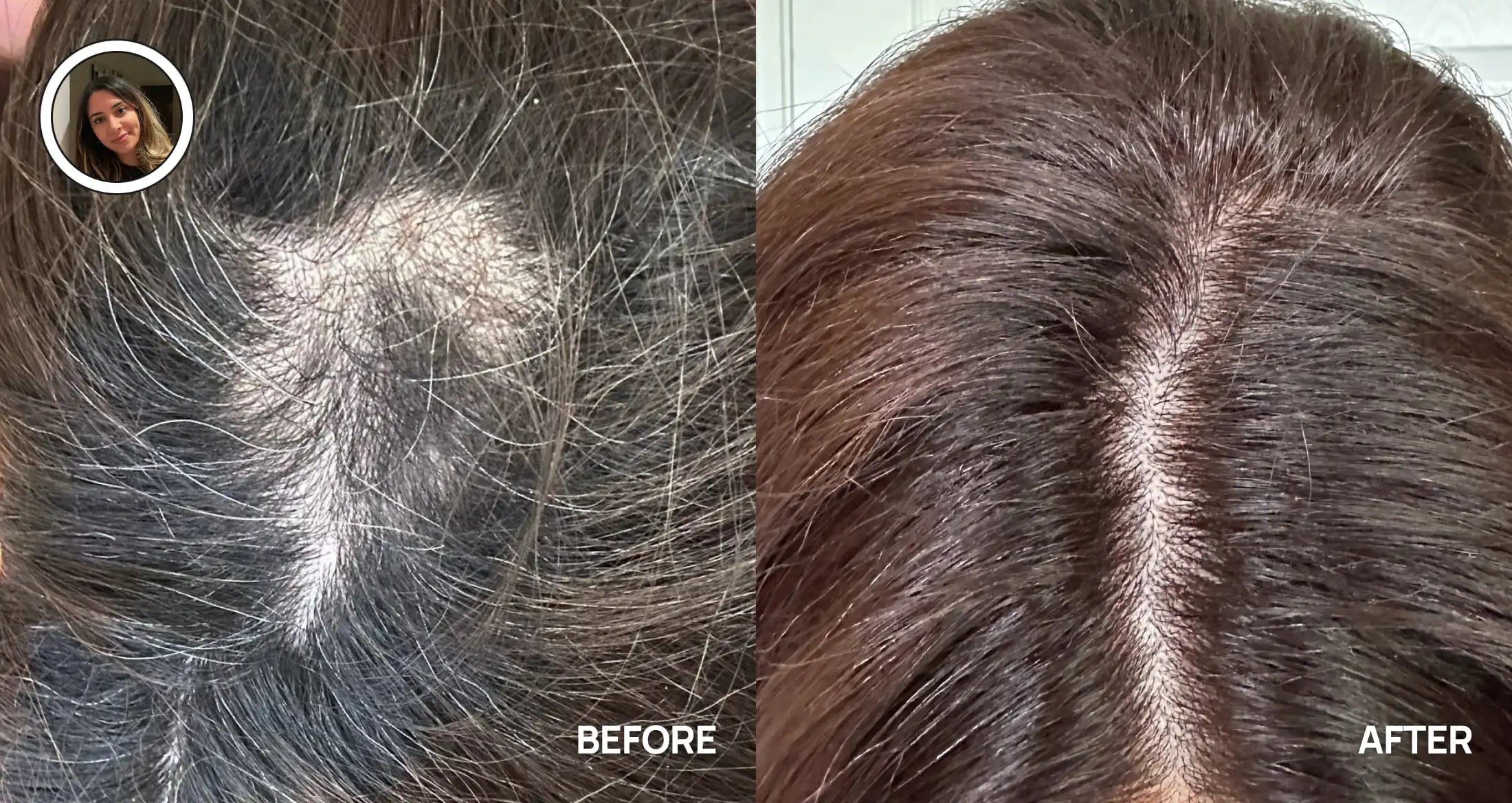 Before and after comparison of hair treatment on a person's head.