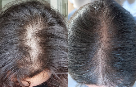 Before and after comparison of hair treatment on a person's head.