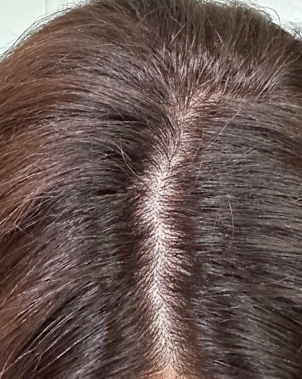 Close-up of a person's head with dark hair